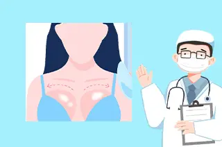 前胸长一块块白斑是白癜风吗