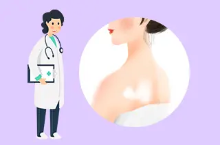 后背白了一块是什么如何判断是不是白癜风