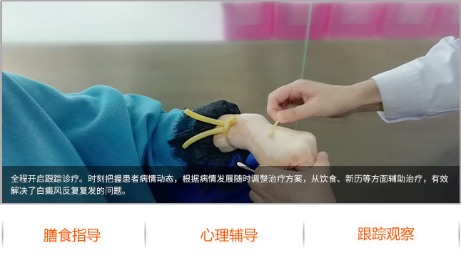 石家庄治疗白斑医院