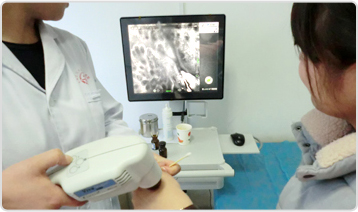 美国三维皮肤CT检测图片